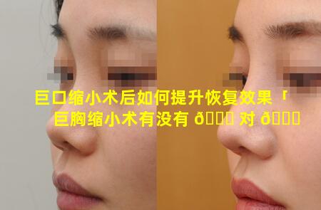 巨口缩小术后如何提升恢复效果「巨胸缩小术有没有 🐋 对 🐋 身体不好」